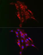 TAGLN2 Antibody in Immunocytochemistry (ICC/IF)