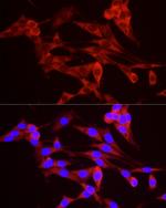 TREX1 Antibody in Immunocytochemistry (ICC/IF)