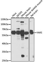 YARS Antibody in Western Blot (WB)