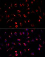 GALNT2 Antibody in Immunocytochemistry (ICC/IF)