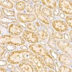 GALNT2 Antibody in Immunohistochemistry (Paraffin) (IHC (P))