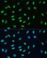 hnRNP M Antibody in Immunocytochemistry (ICC/IF)