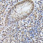 hnRNP M Antibody in Immunohistochemistry (Paraffin) (IHC (P))