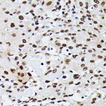 hnRNP M Antibody in Immunohistochemistry (Paraffin) (IHC (P))