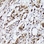 hnRNP M Antibody in Immunohistochemistry (Paraffin) (IHC (P))