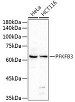 PFKFB3 Antibody in Western Blot (WB)