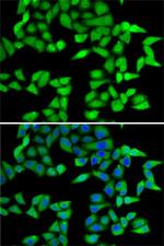 RBBP5 Antibody in Immunocytochemistry (ICC/IF)