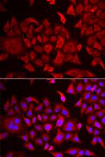 TARS Antibody in Immunocytochemistry (ICC/IF)