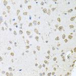 TARS Antibody in Immunohistochemistry (Paraffin) (IHC (P))