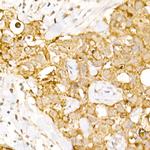 AP3B1 Antibody in Immunohistochemistry (Paraffin) (IHC (P))