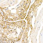 AP3B1 Antibody in Immunohistochemistry (Paraffin) (IHC (P))