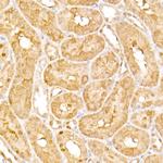 AP3B1 Antibody in Immunohistochemistry (Paraffin) (IHC (P))