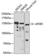 AP3B1 Antibody in Western Blot (WB)