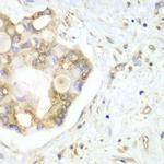 VTI1B Antibody in Immunohistochemistry (Paraffin) (IHC (P))