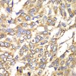 VTI1B Antibody in Immunohistochemistry (Paraffin) (IHC (P))