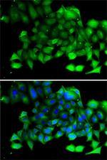 CLIC4 Antibody in Immunocytochemistry (ICC/IF)