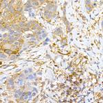 CLIC4 Antibody in Immunohistochemistry (Paraffin) (IHC (P))