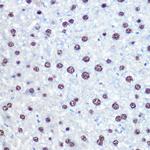 APIP Antibody in Immunohistochemistry (Paraffin) (IHC (P))