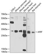 APIP Antibody in Western Blot (WB)