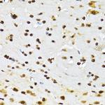 DBC1 Antibody in Immunohistochemistry (Paraffin) (IHC (P))