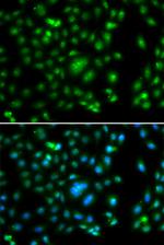 ELF5 Antibody in Immunocytochemistry (ICC/IF)