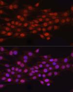 N6AMT1 Antibody in Immunocytochemistry (ICC/IF)