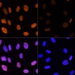 H3K14ac Antibody in Immunocytochemistry (ICC/IF)