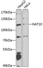 NAT10 Antibody in Western Blot (WB)