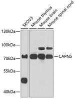 Calpain 5 Antibody in Western Blot (WB)