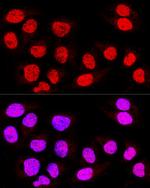 TEF5 Antibody in Immunocytochemistry (ICC/IF)