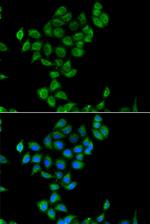 COQ3 Antibody in Immunocytochemistry (ICC/IF)