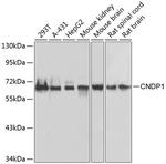 CNDP1 Antibody in Western Blot (WB)