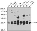 CBR3 Antibody in Western Blot (WB)