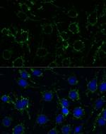 GluD1 Antibody in Immunocytochemistry (ICC/IF)