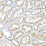 ETFA Antibody in Immunohistochemistry (Paraffin) (IHC (P))