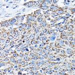 ETFA Antibody in Immunohistochemistry (Paraffin) (IHC (P))