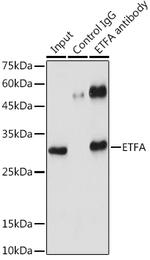 ETFA Antibody in Immunoprecipitation (IP)