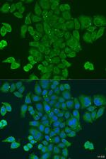 DPM1 Antibody in Immunocytochemistry (ICC/IF)