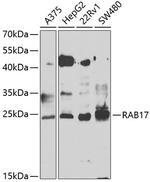 RAB17 Antibody in Western Blot (WB)