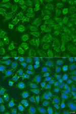 eIF2b alpha Antibody in Immunocytochemistry (ICC/IF)