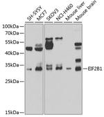 eIF2b alpha Antibody in Western Blot (WB)