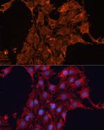 ADAM12 Antibody in Immunocytochemistry (ICC/IF)