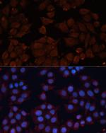 ADAM12 Antibody in Immunocytochemistry (ICC/IF)