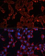 ADAM12 Antibody in Immunocytochemistry (ICC/IF)