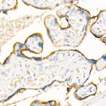 ADAM12 Antibody in Immunohistochemistry (Paraffin) (IHC (P))