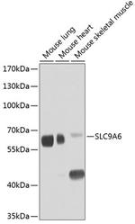 SLC9A6 Antibody in Western Blot (WB)