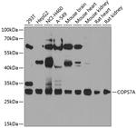 COPS7A Antibody in Western Blot (WB)