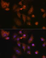 RSPO1 Antibody in Immunocytochemistry (ICC/IF)