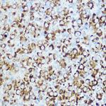 RSPO1 Antibody in Immunohistochemistry (Paraffin) (IHC (P))