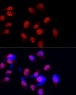 METTL3 Antibody in Immunocytochemistry (ICC/IF)